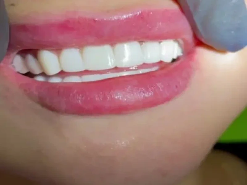 Tori-Dent